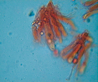 Tricholoma equestre vs. Tricholoma chrysophyllum